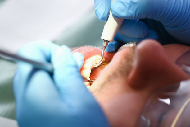 Best Emergency Broken Tooth Repair in New Hackensack, NY